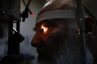 Las cataratas son una enfermedad que provocan que el cristalino del ojo se opaque y pierda su transparencia. Es por ello que el paciente tiene dificultad para la visión. (ARCHIVO)