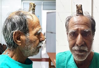 El granjero de 74 años tuvo que someterse a cirugía. (INTERNET)