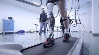 Una prótesis para la pierna que, a través de una aplicación móvil, puede ser modificada para realizar diferentes actividades como bailar o andar en bicicleta. (ESPECIAL)