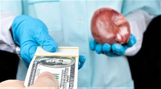 De acuerdo con la Organización Mundial de la Salud (OMS), el trasplante de órganos comprados a la población depauperada constituye hasta 10 por ciento de todas las actividades de esta índole llevadas a cabo a nivel mundial. (ESPECIAL)