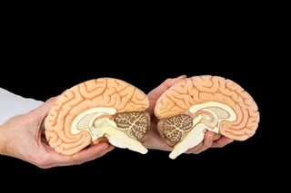 El cerebro de pacientes a quienes se les extirpó un hemisferio para reducir las convulsiones epilépticas formó conexiones en la mitad restante que permitieron que el cuerpo funcionara casi normalmente. (ARCHIVO) 