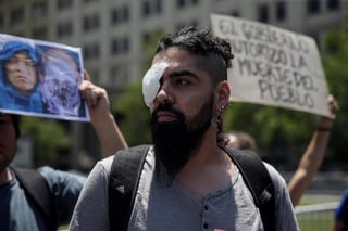“En Chile pedir dignidad cuesta un ojo de la cara”, rezaba una de las pancartas de los familiares y víctimas de daños oculares que han dejado las protestas en Chile y que se manifestaron el jueves frente al palacio presidencial de La Moneda. (EFE) 