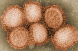 De acuerdo con el último reporte de la Dirección General de Epidemiología, con corte del siete de febrero del 2020, se han reportado tres mil 279 casos positivos de influenza y 149 muertes, de las cuales la mayor parte fueron por el virus H1N1. (ESPECIAL)

