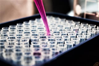 Para la investigación, los científicos del Centro Johns Hopkins utilizaron las técnicas de secuenciación profunda de ARN y espectrometría de masas, con la finalidad de identificar químicos en la orina asociados con el cáncer de próstata en 126 personas sanas y con la enfermedad. (ESPECIAL)