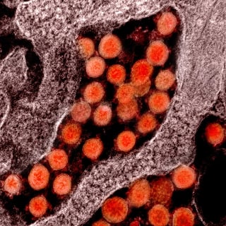 En las últimas horas la cifra de fallecidos a causa del coronavirus suman nueve en el estado de Washington, Estados Unidos y al menos 27 casos confirmados en todo el estado. (ARCHIVO)
