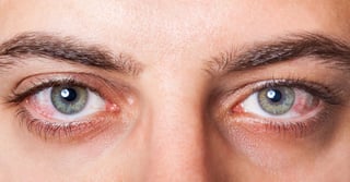 Es la principal causa de ceguera en personas de 60 años en adelante, generalmente esto puede prevenirse si se trata de forma precoz.  (ARCHIVO) 