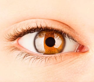 El glaucoma es la lesión del nervio óptico frecuentemente asociado al aumento de la presión del ojo, lo cual conduce a una pérdida de vista progresiva e irreversible. (ARCHIVO) 
