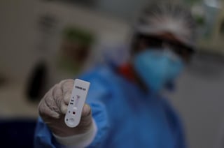 Las autoridades sanitarias de Brasil autorizaron este martes a las farmacias del país realizar test rápidos de anticuerpos para el nuevo coronavirus. (ARCHIVO) 