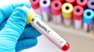 El Gobierno de México, a través de la Secretaría de Salud (SSa), informó que impulsa el primer programa nacional de eliminación de la hepatitis C en América. (ESPECIAL) 
