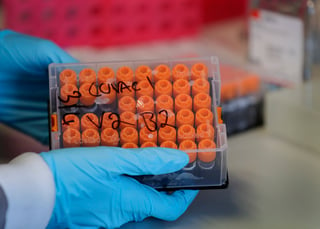 La vacuna del Imperial College usa cadenas sintéticas de código genético basado en el virus. (AP) 