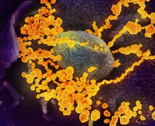 Algunas personas sanas tienen células inmunitarias que son capaces de reconocer al SARS-Cov-2 y el motivo podría encontrarse en infecciones previas con otros coronavirus como el del 'resfriado común'. (ARCHIVO) 