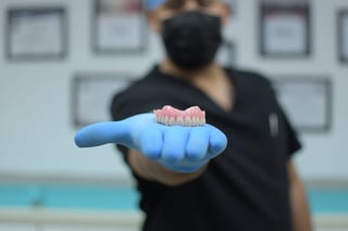 La función de los implantes dentales