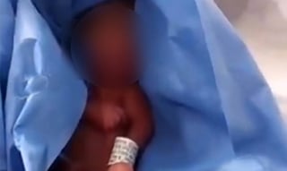Mediante un comunicado el Hospital General de Zona No. 20 La Margarita del IMSS, afirmó que se le había realizado una evaluación al bebé al momento de su nacimiento, determinando que el infante no presentaba signos vitales (ESPECIAL) 