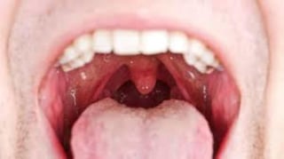 La saliva es importante para degustar, digerir, tragar o defendernos de patógenos, pero ¿cómo se genera? Un nuevo estudio revela detalles de cómo las glándulas salivales producen, de manera colectiva, el conjunto de proteínas que está en la saliva, abriendo la puerta a importantes investigaciones médicas. (ESPECIAL) 