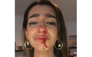 Eva Vildosola Léo, pamplonesa transexual de 19 años, fue golpeada e insultada gravemente a las puertas de su casa de Barcelona por su condición sexual. (ESPECIAL)
