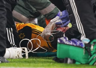 El delantero se marchó del campo inmovilizado y con oxígeno asistido tras un choque con David Luiz. (EFE)