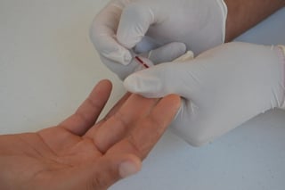 Israel de la Rosa indicó que es importante que las personas se realicen la prueba diagnóstica de VIH para evitar que en caso de tener COVID-19 el virus ataque al organismo de manera más agresiva.