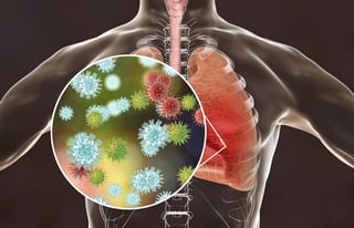 Según un estudio realizado en la Universidad de Radboud, en Países Bajos, los pulmones de las personas que presentaron síntomas graves por COVID-19, tardarían hasta tres meses en recuperarse (ESPECIAL) 