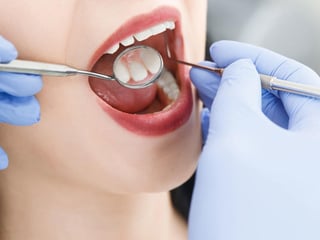 Rompía los dientes de los pacientes y luego cobraba a los seguros por las reparaciones dentales. (INTERNET)