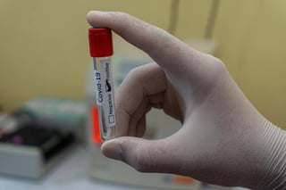 A lo largo de la pandemia del nuevo coronavirus han surgido una gran cantidad de estudios en torno a la duración de los anticuerpos, a estos se añade un nuevo trabajo del Biobanco del Reino Unido, el cual afirma que la mayor parte de estas glucoproteínas duran seis meses en la mayoría de los recuperados del COVID-19. (Especial) 