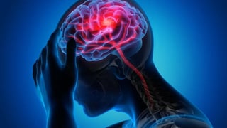 De acuerdo al estudio, los científicos identificaron diversos daños cerebrales en pacientes que se infectaron de COVID-19 (ESPECIAL) 