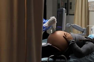 Más de 100 mujeres embarazadas están muriendo al mes en Brasil por COVID-19, más del doble que la tasa del año pasado, informó este jueves The Wall Street Journal, con base en cifras del gobierno. (EFE)