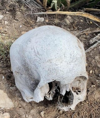 De acuerdo a los exámenes médicos realizados al cráneo descarnado, las autoridades establecieron que se trata de una persona joven y de sexo masculino que murió aproximadamente hace 10 años.

