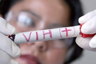 De acuerdo con Salud, en la CDMX, al primer trimestre del año hay
44 mil 722 personas que han sido notificadas de vivir con VIH. (ARCHIVO) 