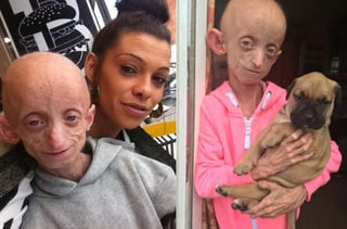 Desde pequeña, Ashanti tuvo que luchar contra el síndrome de progeria de Hutchinson-Gilford, el cual provoca un envejecimiento prematuro en los niños (ESPECIAL) 