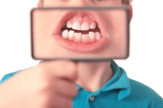 Un 85 por ciento de los infantes y adolescentes entre 6 y 19 años de edad, es decir, que ya tienen la segunda dentición o dientes permanentes, presentan esta enfermedad. (ARCHIVO)