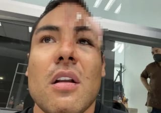 Este fin de semana el actor y reportero de Televisa, Jonathan Ordóñez exhibió en redes sociales la agresión que recibió por parte de sus vecinos tras culparlo de contargiarse de COVID.