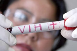 De enero a septiembre de 2021 aumentaron en Coahuila los casos nuevos de personas con el Virus de la Inmunodeficiencia Humana (VIH) respecto al mismo periodo pero del año pasado. (ARCHIVO) 
