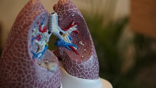Nuevas opciones terapéuticas elevan esperanzas de pacientes con cáncer de pulmón en México