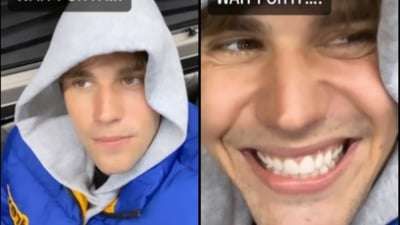 Imagen Justin Bieber muestra cómo está recuperando su sonrisa tras parálisis facial