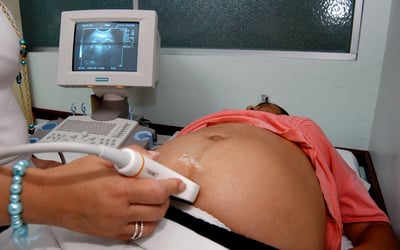 La OMS explica que muchas mujeres mueren de complicaciones que se producen durante el embarazo y el parto o después de ellos. (ARCHIVO)