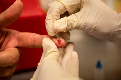 Se evaluará la eficacia de lenacapavir de acción prolongada para disminuir las probabilidades de adquirir VIH. (ARCHIVO)