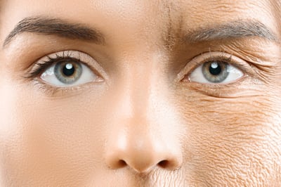 Imagen Reemplaza el colágeno por estos hábitos para evitar arrugas