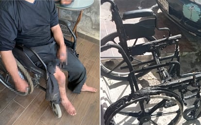 En la colonia Valle Verde, de Torreón, un hombre prendió fuego a su silla de ruedas y sufrió quemaduras en las piernas.