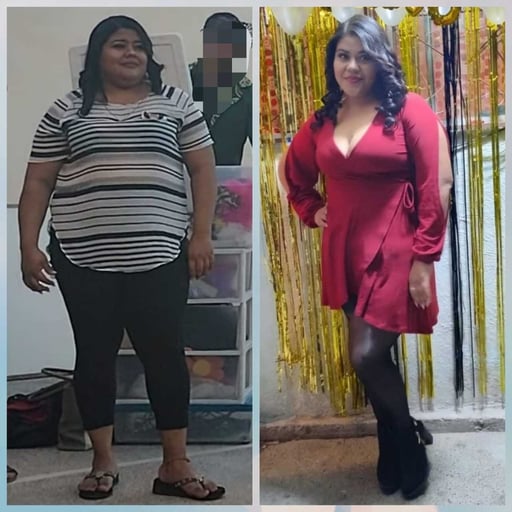 Diana dice que la cirugía bariátrica que le hicieron en el Hospital General, le cambio la vida.
