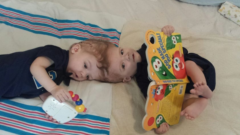 Nueva York (Estados Unidos).- Una foto proporcionada por el Hospital Infantil de Montefiore Medical Center, muestra dos hermanos gemelos siameses Anias y Jadón McDonald en un lugar no revelado. Los gemelos de 13 meses de edad que estaban unidas por sus cabezas han sido separados en una cirugía que se llevó a cabo durante 16 horas del 13 de octubre al 14 de de octubre de 2016 en el Hospital Infantil del Centro Médico Montefiore en el barrio del Bronx en Nueva York, Nueva York, EE.UU.. EFE