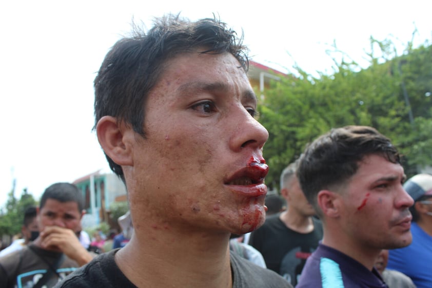 MEX8464. TAPACHULA (MÉXICO), 18/03/2022.- Migrantes resultan lesionados durante la protesta hoy, en las oficinas de la regulación migratoria del Instituto Nacional de Migración (INM), en la ciudad de Tapachula, estado de Chiapas (México). Unos 500 migrantes realizaron este viernes bloqueos, marchas y manifestaciones en las calles de Tapachula, en el suroriental estado mexicano de Chiapas, para exigir al Instituto Nacional de Migración (INM) que les otorgue las visas humanitarias para poder salir de la entidad. EFE/Juan Manuel Blanco