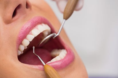 Recomendaciones para el proceso de remineralización de los dientes