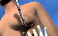 Una mujer de 42 años falleció al interior de una clínica de belleza ubicada en la colonia Huexotitla de la ciudad Puebla, cuando se realizaba una operación de liposucción y aumento de senos. (TWITTER)