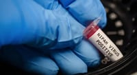 Embajada de la India en México, desmiente información que circula en redes respecto a un 'nuevo' brote por Nipah (ESPECIAL)  