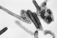 Las autoridades de África occidental confirmaron el primer caso conocido de virus de Marburgo en la región, después de que por lo menos una persona falleció de la fiebre hemorrágica en Guinea, anunció el lunes la Organización Mundial de la Salud.