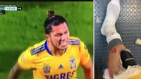 Golpean a Carlos Salcedo dentro y fuera de la cancha tras el Santos Vs. Tigres 