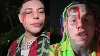 Imagen Eduin Caz y 6ix9ine aparecen con heridas en la cara en redes sociales; ¿qué pasó?