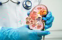 Señales del cuerpo para detectar problemas en los riñones