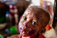 Imagen África registra más de 111 mil casos de mpox, van más de mil 700 muertos