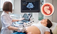 Imagen ¿Cómo elegir el doctor ideal para el parto?